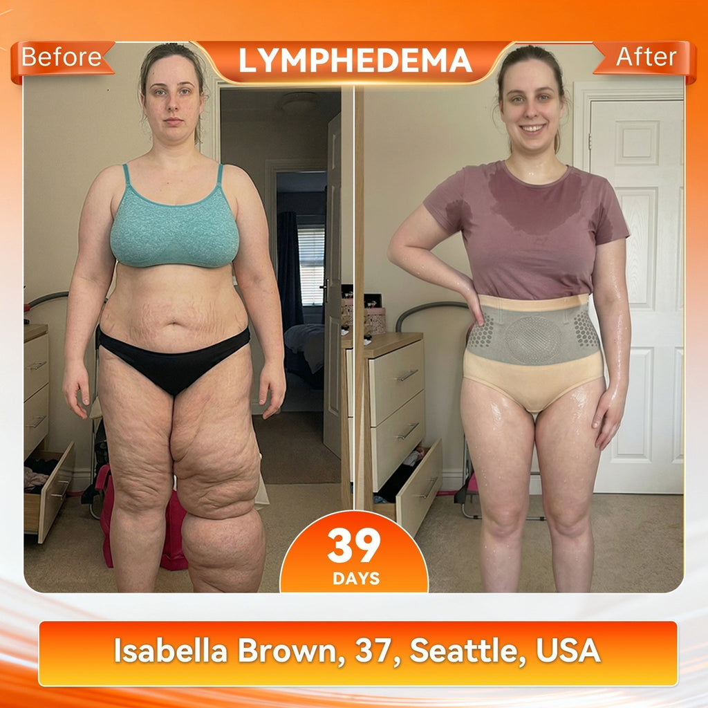 💃 Transform Your Body – HOOMWELL® Micro-Particle Fat-Burning Shorts