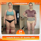 💃 Transform Your Body – HOOMWELL® Micro-Particle Fat-Burning Shorts