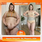 💃 Transform Your Body – HOOMWELL® Micro-Particle Fat-Burning Shorts