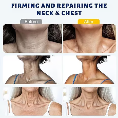 LiftRoll Pro Collagen Sculpting Neck Cream 🧴 | Firms Neck, Reduces Wrinkles & Double Chin✨