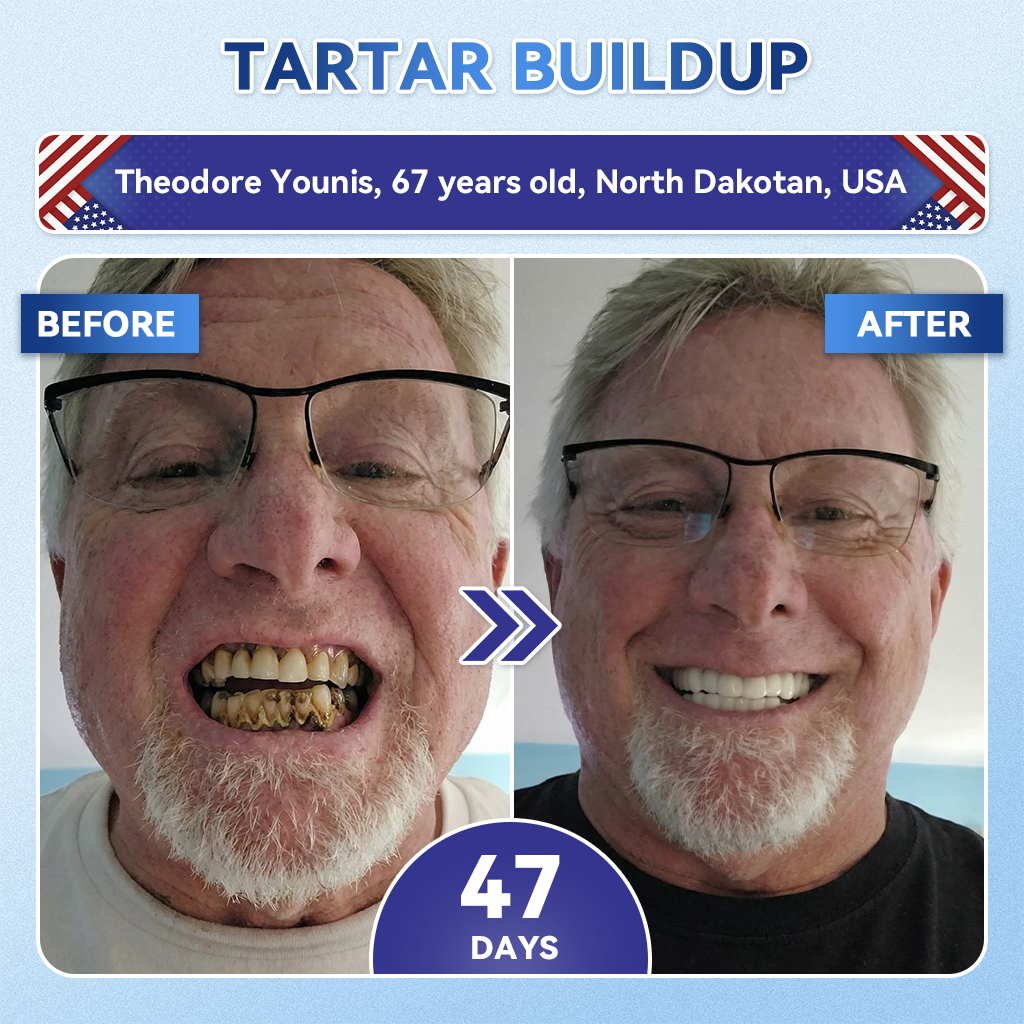 Glimmerly® 🦷 Tideglusib Fast‑Dissolving Tooth & Gum Repair Oral Strips