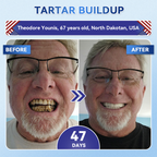 Glimmerly® 🦷 Tideglusib Fast‑Dissolving Tooth & Gum Repair Oral Strips
