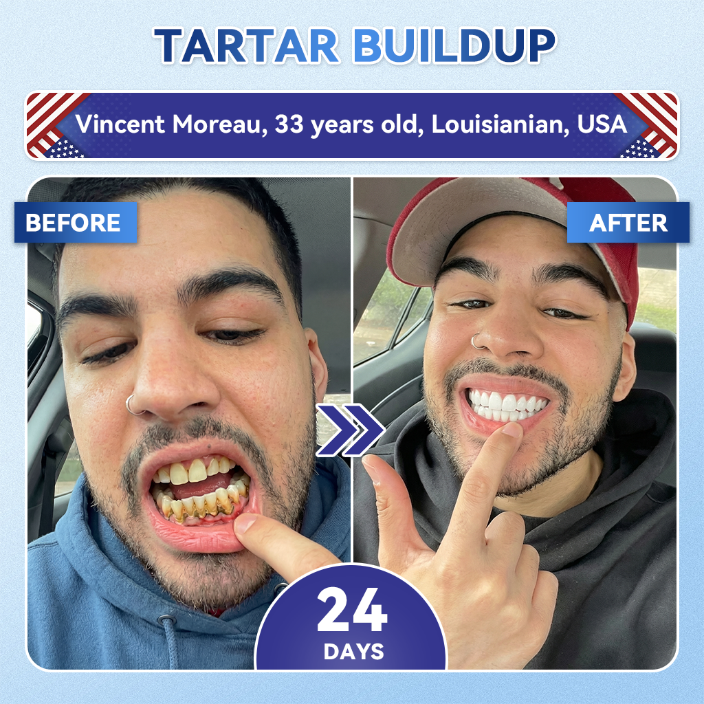 Glimmerly® 🦷 Tideglusib Fast‑Dissolving Tooth & Gum Repair Oral Strips