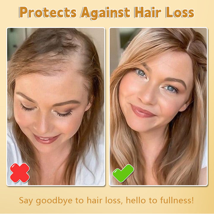 Biotin Hair Growth Essence Spray