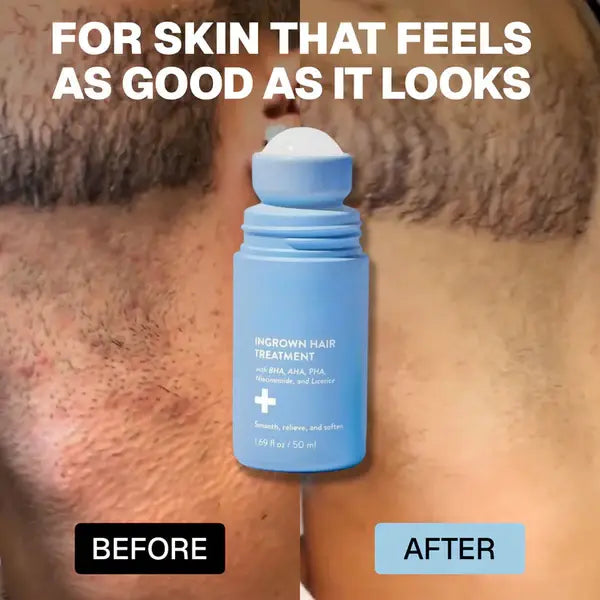 Vitaliaina: Smoothing Solution For Ingrown Hairs