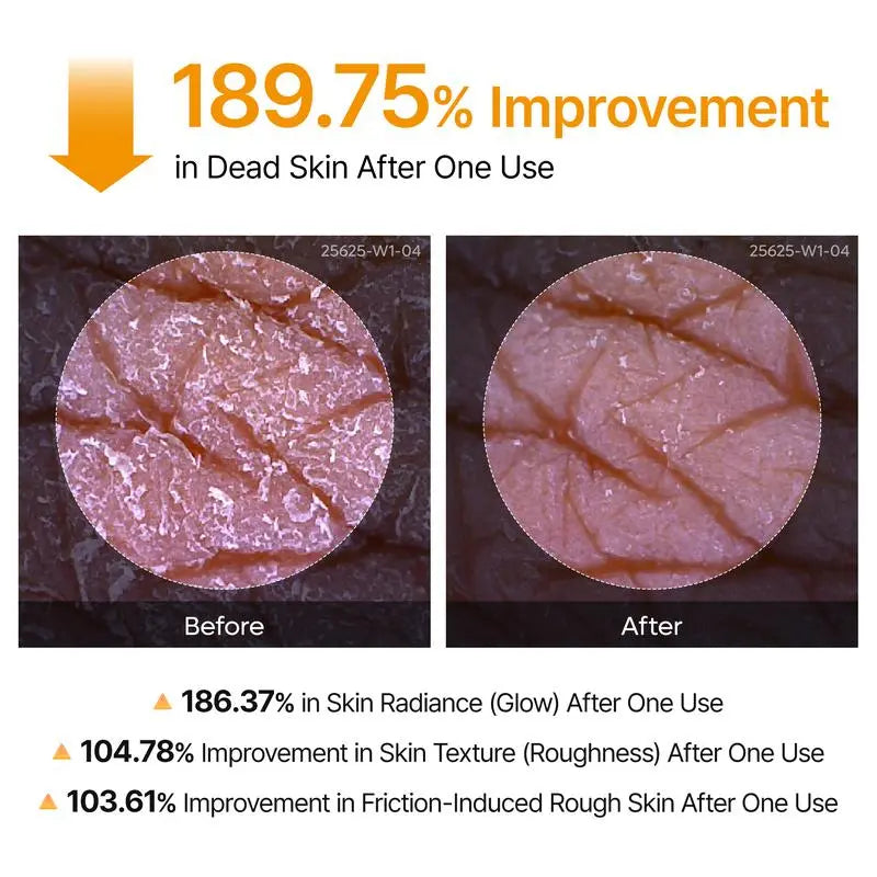 Keratin Turmeric Kojic Acid Spray 200ml, Pore Exfoliating Skin Repair