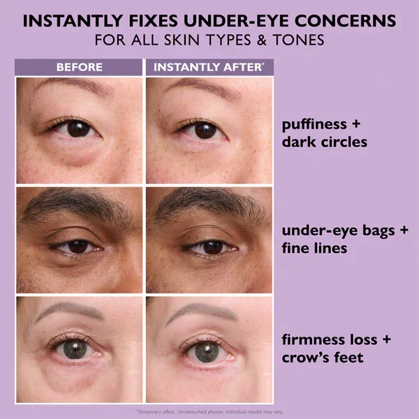 Instant Eye Tightener Easy- Ultimate Lift & Smooth Finish