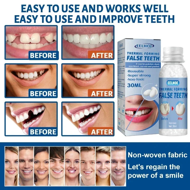 Resin 30ml Temporary Tooth Repair Teeth Gaps False Teeth Solid Glue Denture Adhesive Teeth Whitening-Tooth Beauty