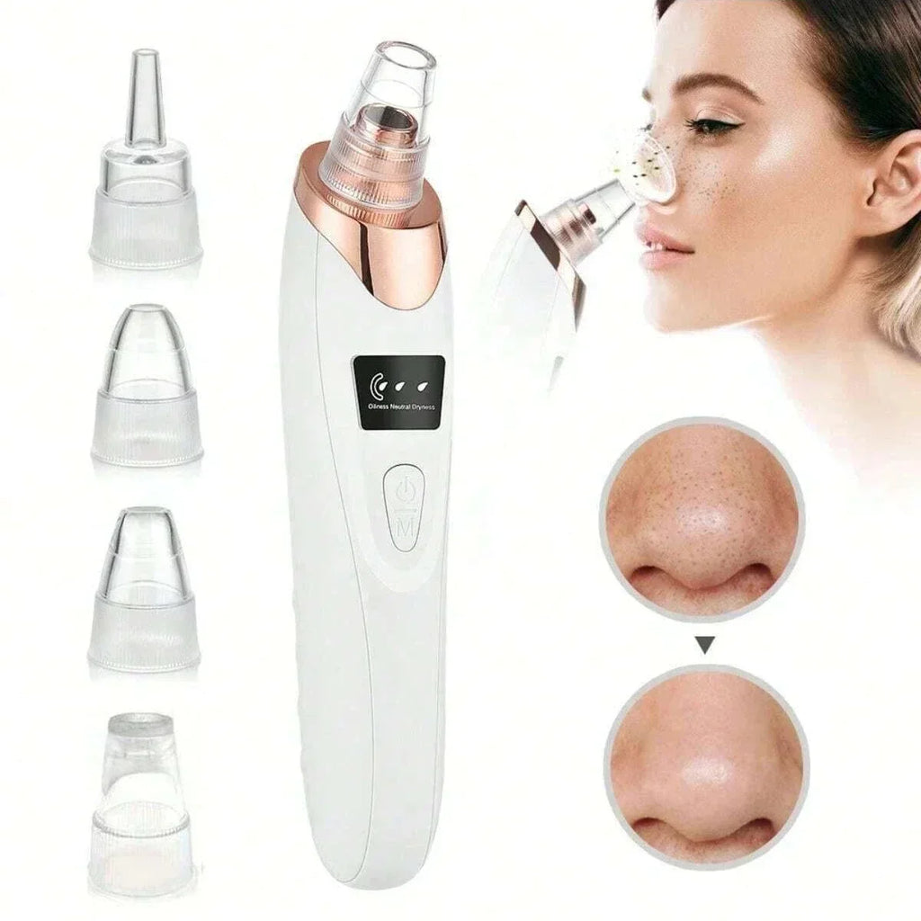 Electric Blackhead Remover Vacuum Cleaner - Facial Deep Cleansing Pore Cleaner for Black Spots Removal Skin Care Tools Beauty World Shop