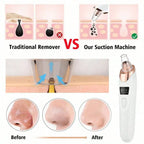 Electric Blackhead Remover Vacuum Cleaner - Facial Deep Cleansing Pore Cleaner for Black Spots Removal Skin Care Tools Beauty World Shop