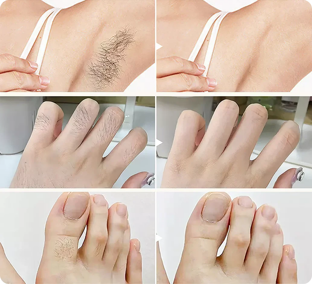 Gentle Growth Inhibition: Coconut Hair Removal Cream