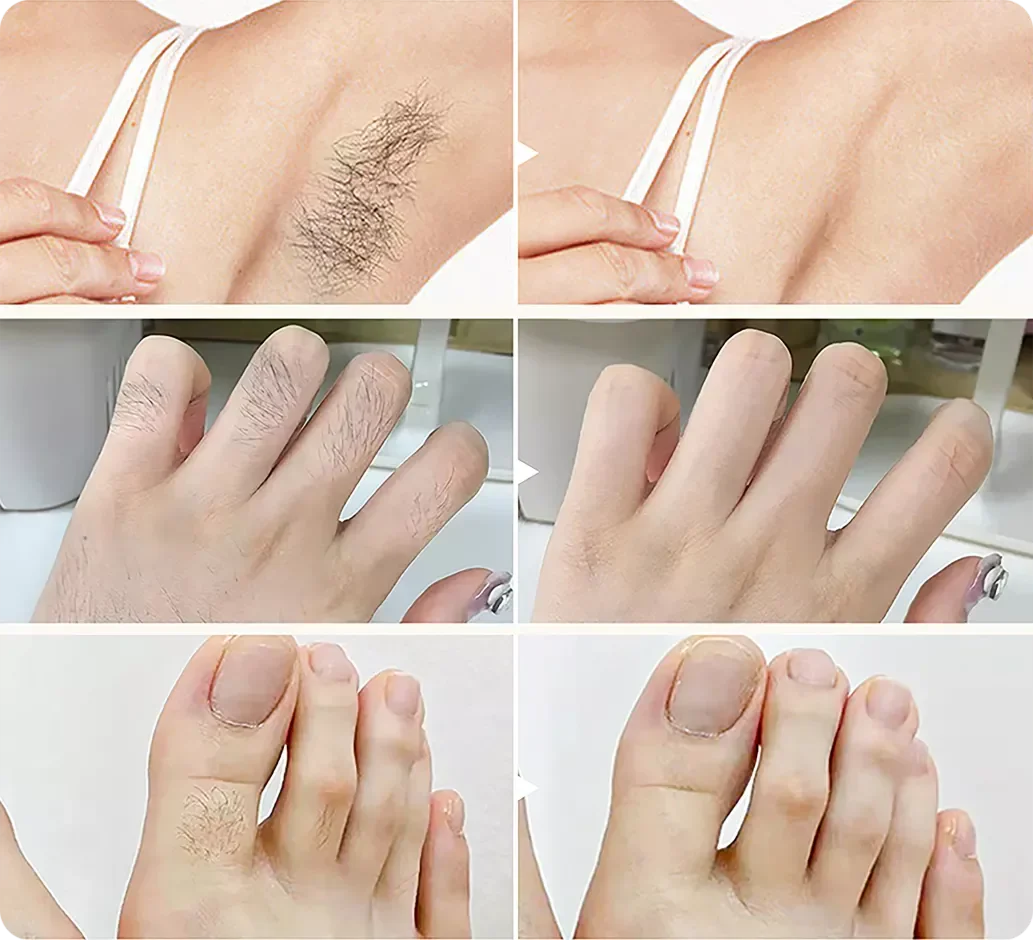 Gentle Growth Inhibition: Coconut Hair Removal Cream