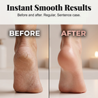 Rechargeable Electric Pedicure Tool with Smart Pressure Sensor